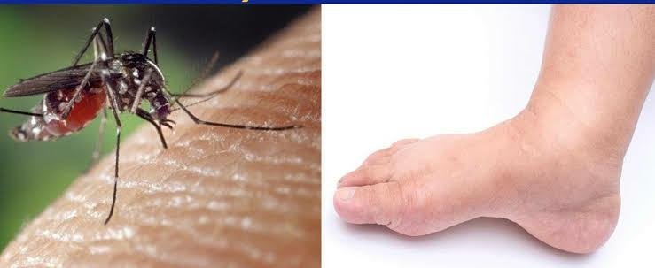 Rashtriya Mashal | बापू जयंती पर फाइलेरिया एवं कालाजार  को खत्म करने का...